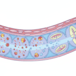 How Homocysteine Damages Blood Vessel Cells Through Oxidative Stress Featured image for How Homocysteine Damages Blood Vessel Cells Through Oxidative Stress